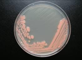 Rhodosporidium 4a Konidiji so podolgovati, eno- in