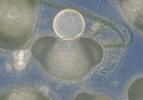 Sistem gliv Kraljestvo pravih gliv (Fungi) ločimo na štiri debla po