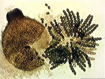 Ascomycota Zigospora.