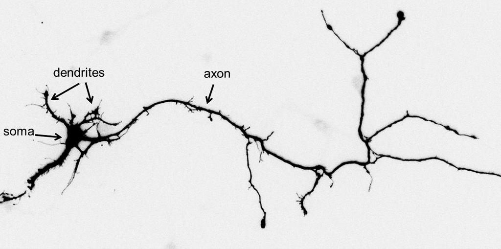 Μοντέλο νευρώνα ΚΝΣ: εμβρυικοί