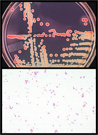 CIN agar