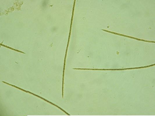 ανθεκτικοί σε ακραία περιβάλλοντα Microcystis aeruginosa Cylindrospermopsis raciborskii Παράγουν