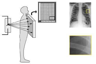 Viedtekstila sensoru sistēmas medicīnā un sportā. Biotekstils.