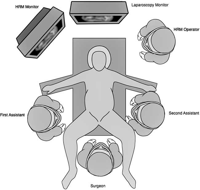 Triantafyllou et al Surg Laparosc Endosc Percutan Tech Volume 26, Number 6, December 2016 The protocol included patients older than 18 years old who had given consent to the study.