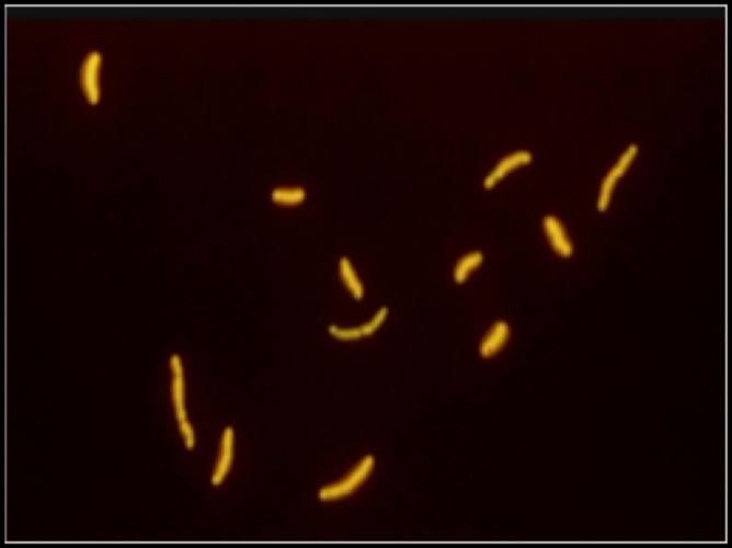 Rossman MD. Pulmonary tuberculosis.