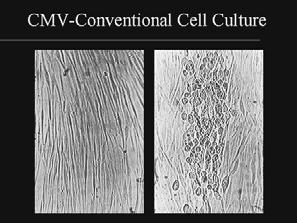 CMV αντιγοναιμία (pp65) Διάγνωση συγγενούς CMV λοίμωξης στο νεογνό Καλλιέργειες Shell vial assay CMV