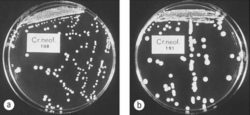 Cryptococcus capsule.