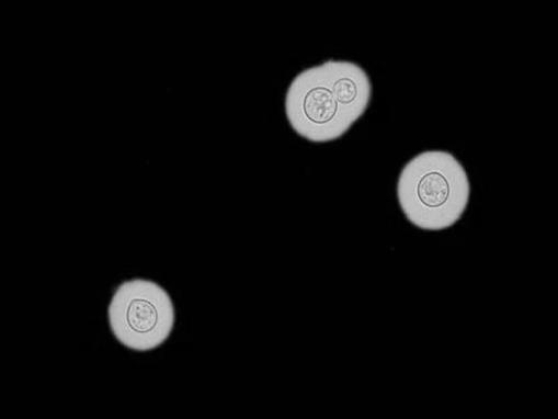 A large protective polysaccharide capsule surrounds each cell.