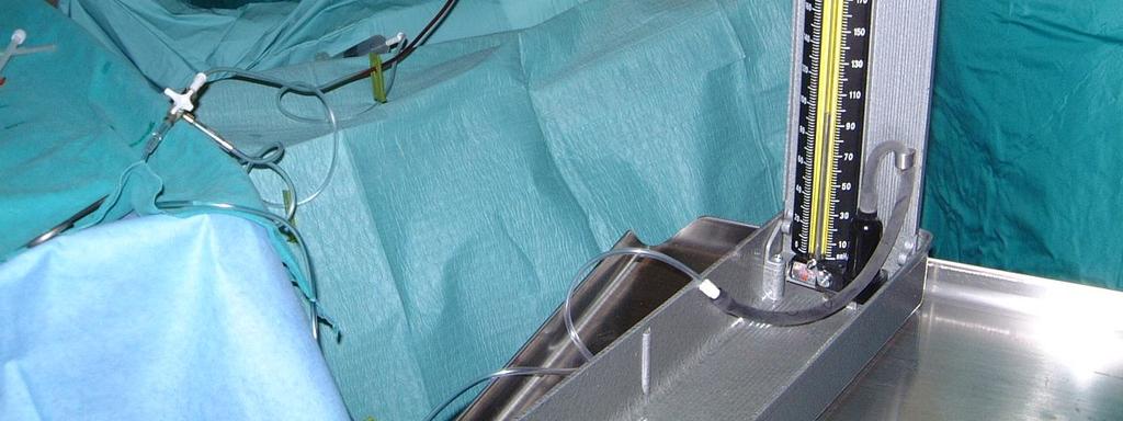mmhg Κρίσιμη