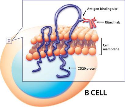 Rituximab (Anti-CD20 μονοκλωνικό αντίσωμα) Είναι ένα χιμαιρικό μονοκλωνικό αντίσωμα Στρέφεται έναντι του CD20 ενός διαμεμβρανικού