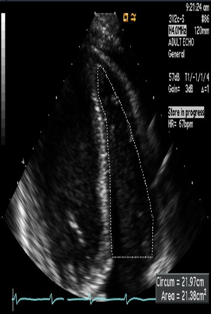 9 RVOT-SF RVOT1 2.