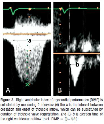 (end-diastolic