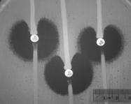 Ταξη A Chromosomally encoded Serratia marcescens enzyme (SME) Not metalloenzyme carbapenemases (NMC) Imipenem hydrolyzing β lactamases (IMI) Plasmid encoded Klebsiella pneumoniae carabapenemases