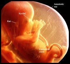 πόσο μικρός είναι ή όχι." Life is present from the moment of conception. Dr.