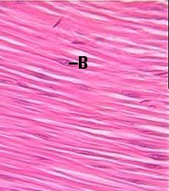Λείος μυς Ο λείος μυς αποτελείται από επιμήκη, όχι γραμμωτά, κύτταρα κάθε ένα από τα οποία περιβάλλεται από βασικό υμένα και ένα δίκτυο δικτυωτών ινών.