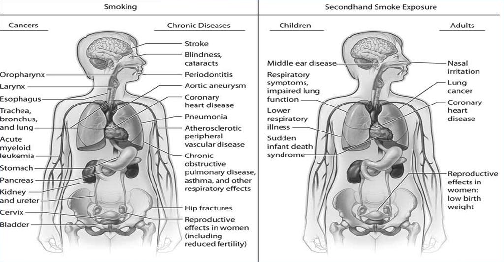 Tobacco use damages every part of the body, including