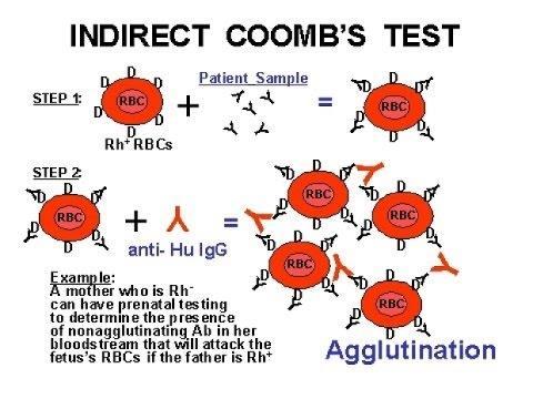 Έμμεση δοκιμασία αντισφαιρινικού ορού - Έμμεση Coombs Indirect Antiglobulin Test (IAT) Ένα αρχικό στάδιο επώασης στους 37 C, κατά το οποίο αναμιγνύονται ερυθρά με δείγμα ορού, ώστε αν υπάρχουν ατελή