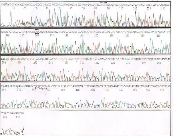 II krug PCR produkt 300 bp restrikcija (BamHI i NdeI); 5-10 U enzima ligacija pgem -Teasy transformacija detekcija plazmida colony PCR