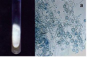 Καλλιέργεια Sabouraud dextrose agar Θερμοκρασία: 25 30 ο C Σωληνάρια με κεκλιμένο