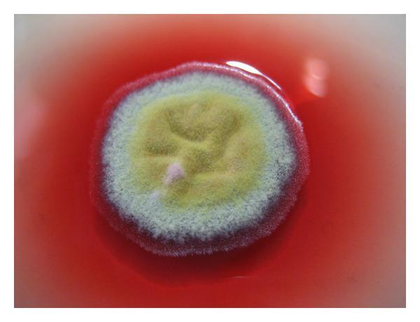 Καλλιέργεια σε SDA στους 25 ο C παρουσιάζει τυπική μορφολογία Penicillium