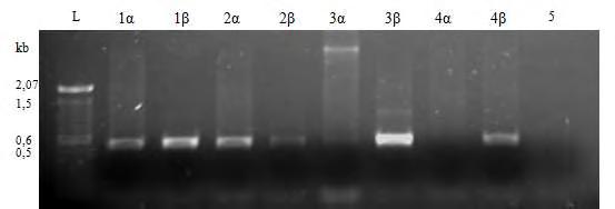 ΑΠΟΤΕΛΕΣΜΑΤΑ Εικόνα 29. Πηκτή αγαρόζης με PCR προϊόντα από την ενίσχυση τμήματος του ceha γονιδίου στα βακτήρια που αποδομούν το oxamyl. Γραμμές 1α: Ολικό DNA ΟΧΑ 17 (Pseudomonas sp.