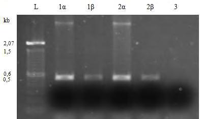 putida), 4β: Πλασμιδιακό DNA ΟΧΑ 25, 5: Αρνητικός μάρτυρας. Εικόνα 30.