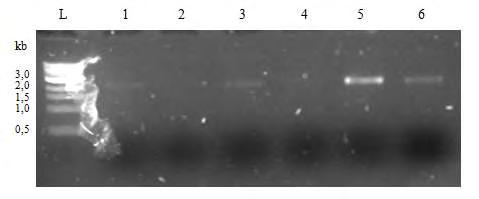 ΑΠΟΤΕΛΕΣΜΑΤΑ Εικόνα 31. Πηκτή αγαρόζης με τα PCR προϊόντα που προήλθαν από την ενίσχυση ολόκληρου του γονιδίου ceha, στα βακτήρια που αποδομούν το oxamyl.