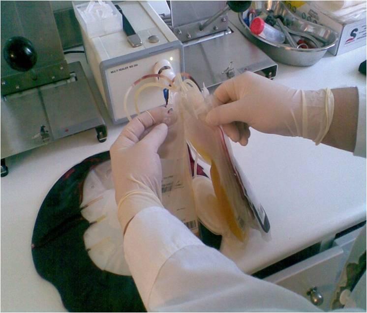 και του ασκού που περιέχει του ολικό αίμα τοποθετούνται στην ειδική υποδοχή της φυγοκέντρου. Εικόνα 8.