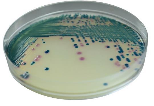 . Ανάλογα του είδους του μικροβίου (εντεροβακτηριακά, Acinetobacter ) Απαιτείται περαιτέρω