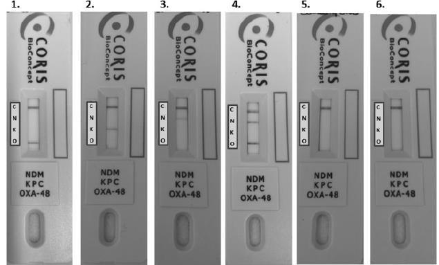 Μέθοδοι ανοσοχρωματογραφίας: ανίχνευση καρβαπεμενασών Ανίχνευση σε στελέχη Εντεροβακτηριακών OXA-48 KPC NDM NDM + OXA-48 Negative Διαθέσιμα για ανίχνευση μίας οικογένειας ενζύμων ή περισσοτέρων
