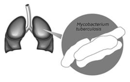 Απαραίτητος ο έλεγχος για λανθάνουσα φυματίωση Ακτινογραφία θώρακος IGRA / TST (5mm) Σε περίπτωση λανθάνουσας φυματίωσης χορηγούμε ισονιαζίδη για 9 μήνες Immune Assays for Diagnosing Latent TB Assays