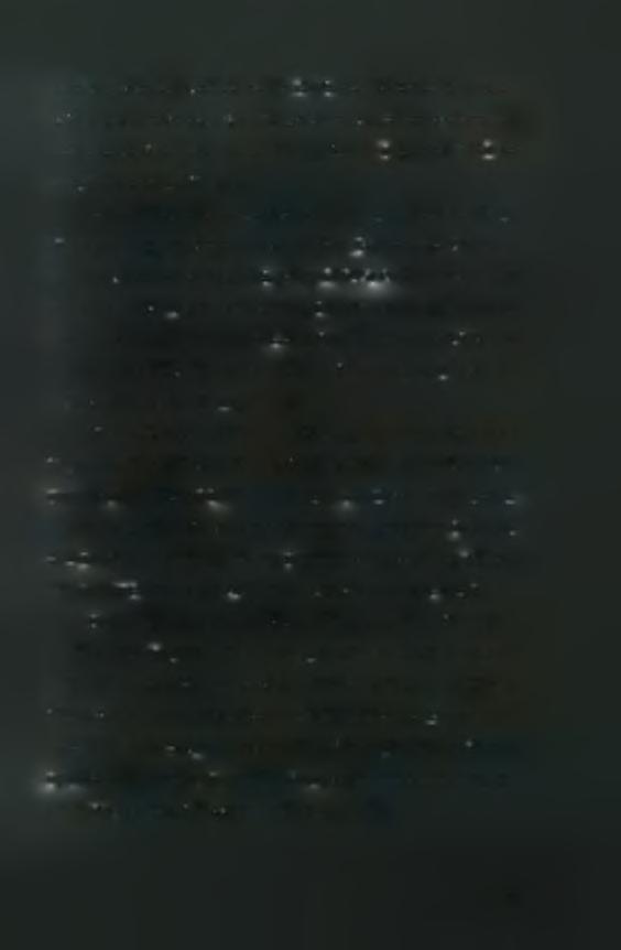 αποτελεί η μελέτη των Cardinale και Lim (2003), όπου δεν παρατηρήθηκε καμία επίδραση της κινητικότητας, μαζικά αθλούμενων ατόμων, μετά την εφαρμογή ενός έντονου πρωτοκόλλου άσκησης με ολόσωμη δόνηση