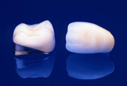 PPF MIXT~ METALO-CERAMIC~ ELEMENTE