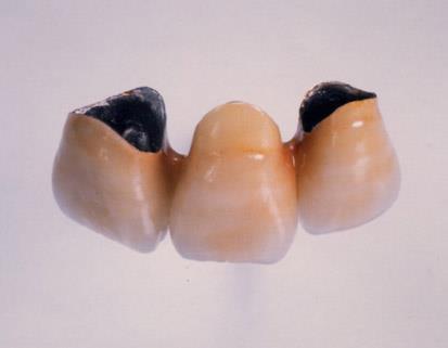 grosime 0,35-0,5 mm excep]ie CMGC
