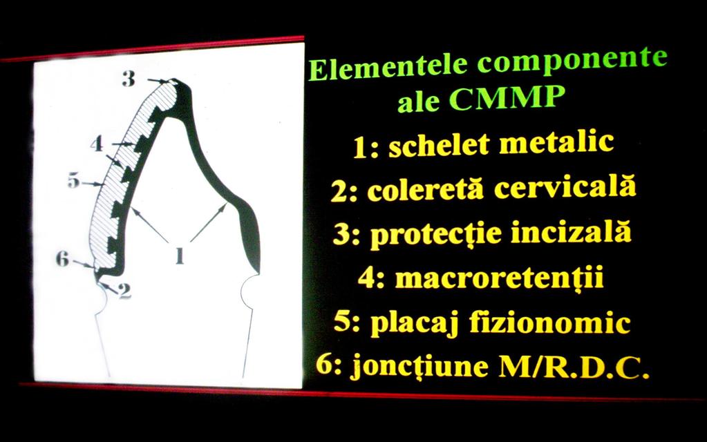 PPF MP