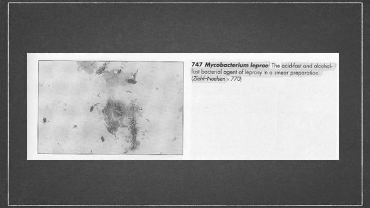 Mycobacterium leprae Οξεοάντοχος βάκιλλος Υποχρεωτικά ενδοκυττάριο 0.5 μm x4.0 7.