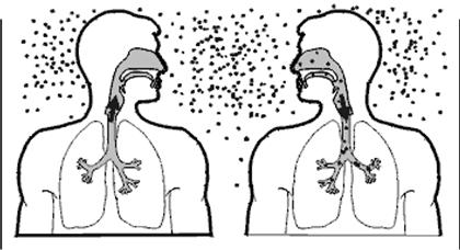 Negative reaction to tuberculin skin test 2 3 4 TB infection No disease Latent tuberculosis TB, clinically active TB Not clinically active Positive reaction to tuberculin skin test Negative