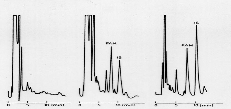 Primer internega standarda: določevanje famotidina plazma plazma + plazma + 100 ng/ml IS