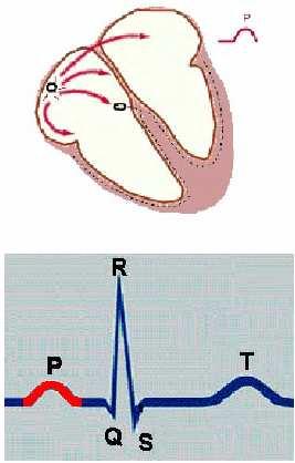Unda P Porţiunea ECG care corespunde depolarizării atriale (AD AS); Defineşte ritmul sinusal; Aspect: rotunjită şi uniformă; Sens: -