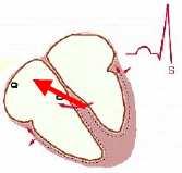 Prima zonă activată a muşchiului ventricular este septul interventricular, cu vectorul rezultant de la stânga spre dreapta şi de jos