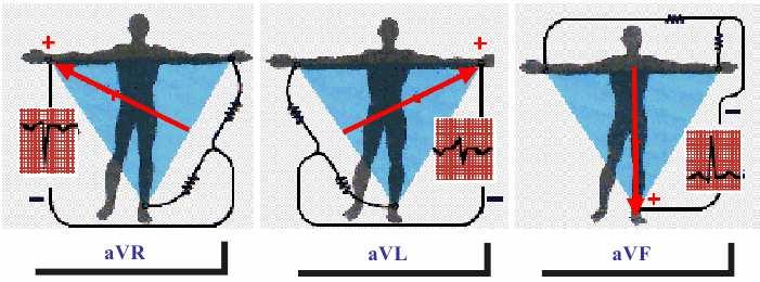 - Cele trei derivaţii bipolare înregistrează diferenţele de potenţial între: - DI -braţul drept (R - ) şi braţul stâng (L + ); - DII-braţul drept (R - ) şi piciorul stâng (F + ); - DIII-braţul stâng
