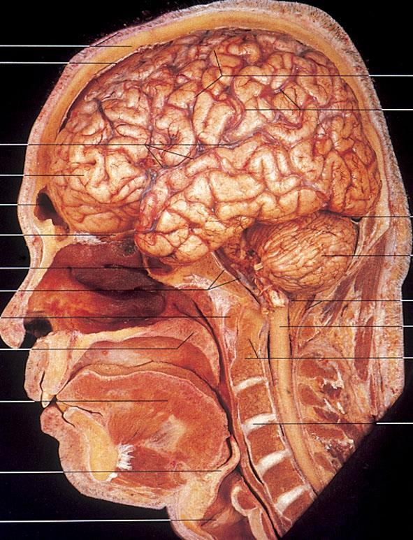 ΕΓΚΕΦΑΛΟΣ Αποτελείται από δύο εγκεφαλικά ημισφαίρια, τα οποία διαχωρίζονται ατελώς από την επιμήκη σχισμή