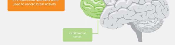 in the dorsolateral prefrontal cortex (DL-PFC) part of the