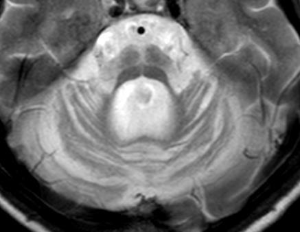 Zobrazovacie vyšetrenia MRI 1.
