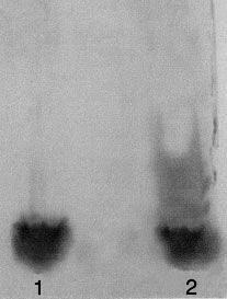 E.coli ( 055:B5, «Sigma»). ( 8). 1, Chlamydia trachomatis ( ) - ; 2 E.coli ( 055:B5, Sigma). 8., Chlamydia trachomatis -.