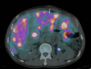 George SP, Vij MS (2012) Image-guided biopsy: what the