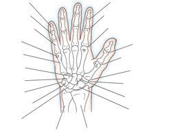 Κεφάλαιο 1 4 Ανατομία και εξέταση του χεριού, του καρπού, του αντιβραχίου και του αγκώνα ΕΙΚΟΝΑ 1-6 Η οστική ανατομία του χεριού.