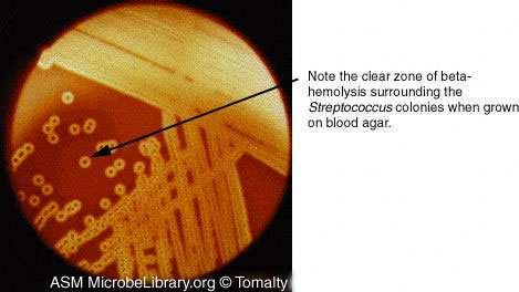 2.1.2 Καλλιεργητικοί χαρακτήρες - αποµόνωση Ο β-αιµολυτικός στρεπτόκοκκος οµάδας αναπτύσσεται εύκολα στο αιµατούχο άγαρ, ενώ δεν αναπτύσσεται σε υλικά χωρίς αίµα, όπως στο σκέτο κοινό θρεπτικό άγαρ.