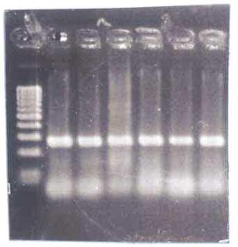 400 bp 300 bp α β Φωτογραφία 9. Στελέχη τα οποία φέρουν το mefa γονίδιο (α) και στελέχη που φέρουν το erma(tr ) γονίδιο (β) 3.2.