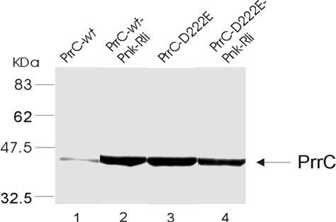ב( תמונה מס' 3.2- ביטוי חלבון PrrC עם חלבוני תיקון.RNA תאי K38 עם הנגזרות השונות של פלסמיד prrc11 גודלו ועברו אינדוקציה לביטוי prrc והגנים לתיקון ה- trna.